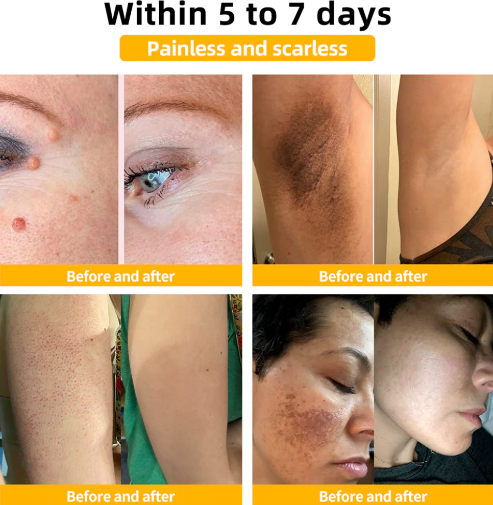 🐝 BEE VENOM ™ Natural Lifting Cream (Original)